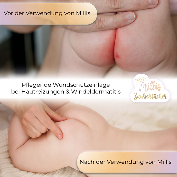 Millis Zaubertücher – 25er Pack