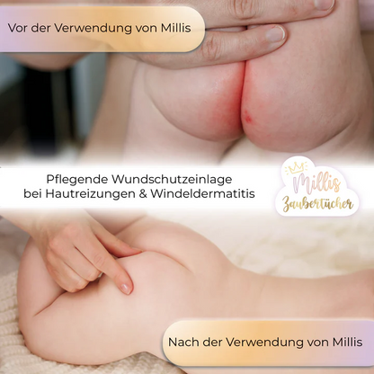 Millis Zaubertücher – 25er Pack
